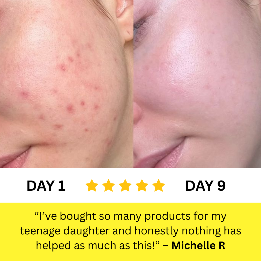 ✨ Turmeric + Kojic Brightening Bar™