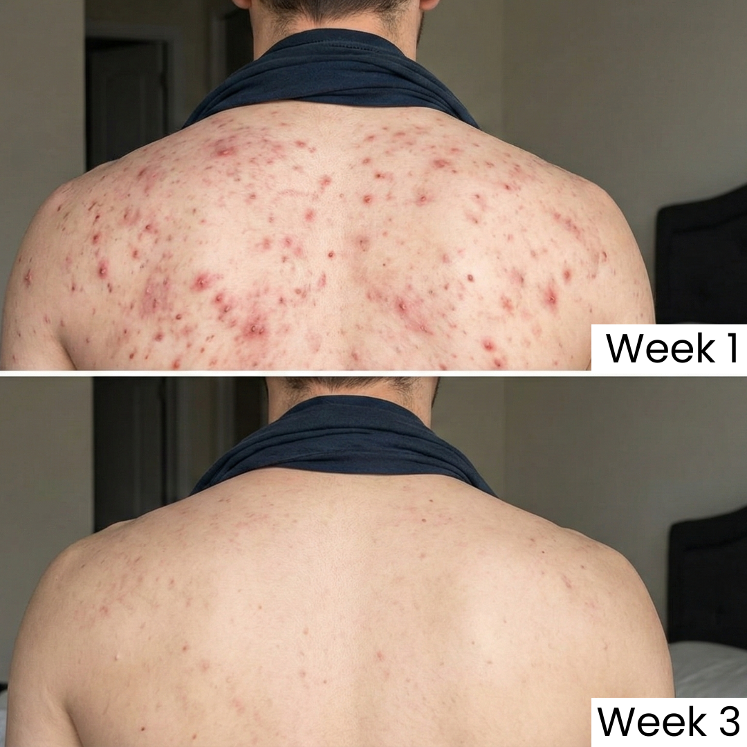 ✨ Turmeric + Kojic Brightening Bar™